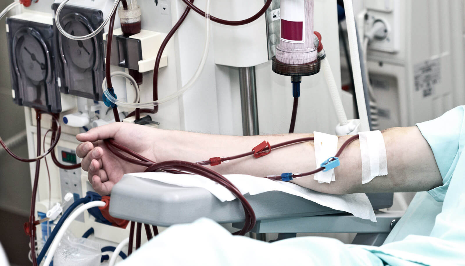 Especialista en diálisis
