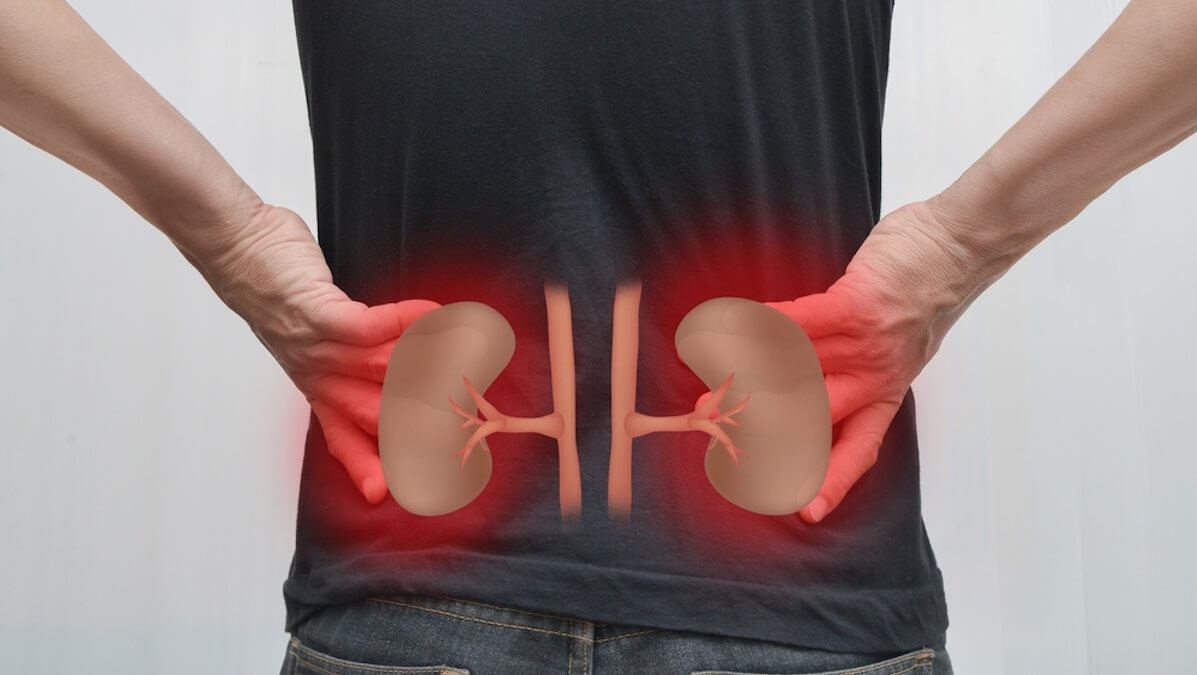 Qué trata un nefrólogo en Metepec Estado de México